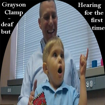 Grayson Clamp, né sourd, entend pour la première fois à l'âge de 3 ans
